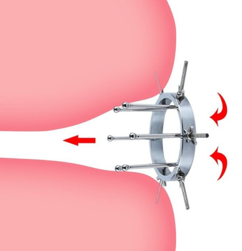 Металлический анальный-вагинальный расширитель,Фистинг  фото 20
